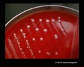 listeria monocytogenes, blood agar